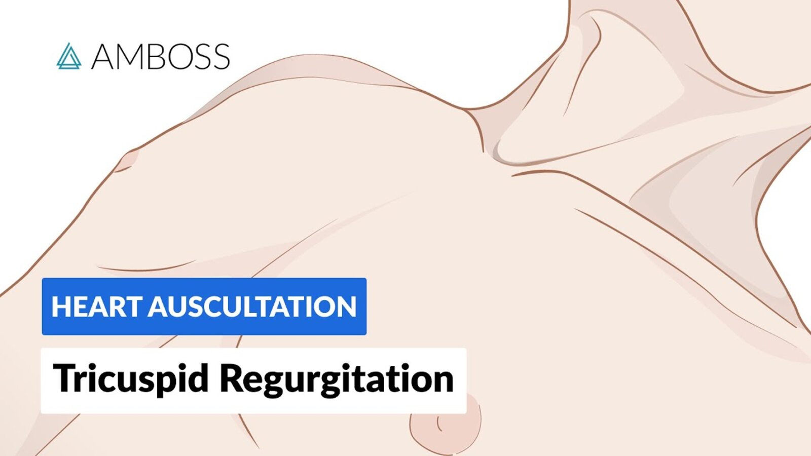 Tricuspid Regurgitation (TR) - Heart Auscultation - Episode 12