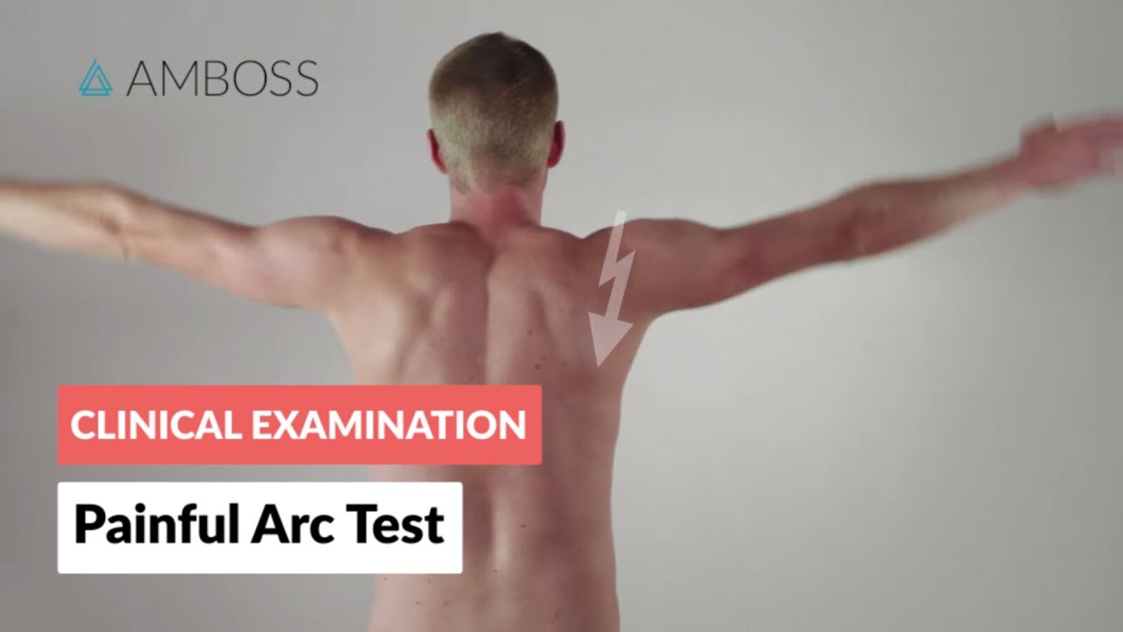 Impingement Syndrome - Painful Arc Test - Clinical Examination