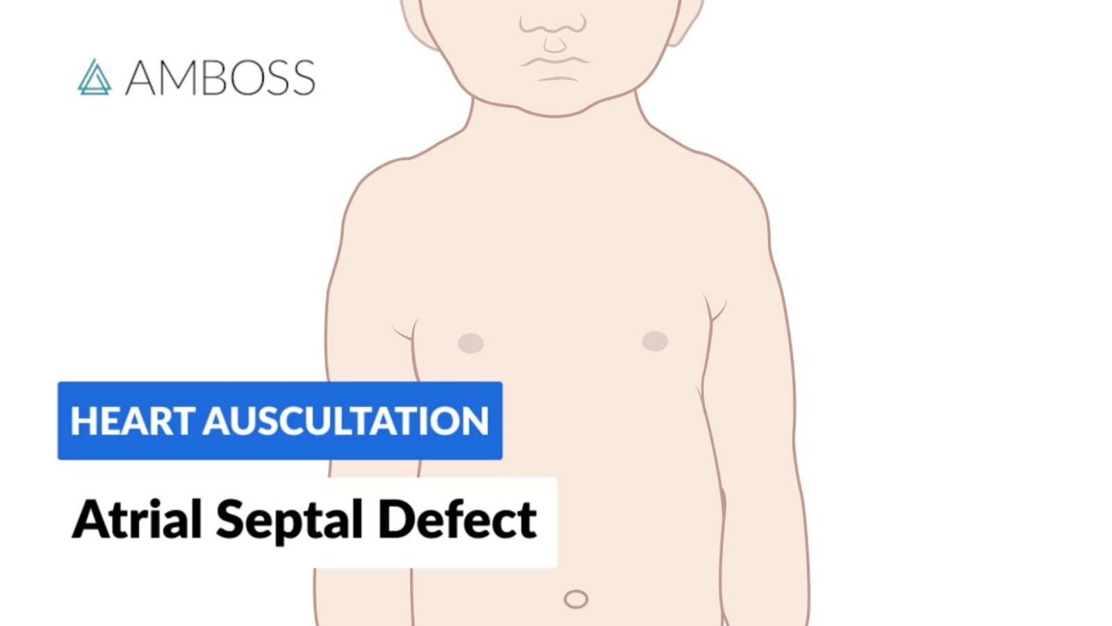 Atrial Septal Defect - Heart Auscultation - Episode 7