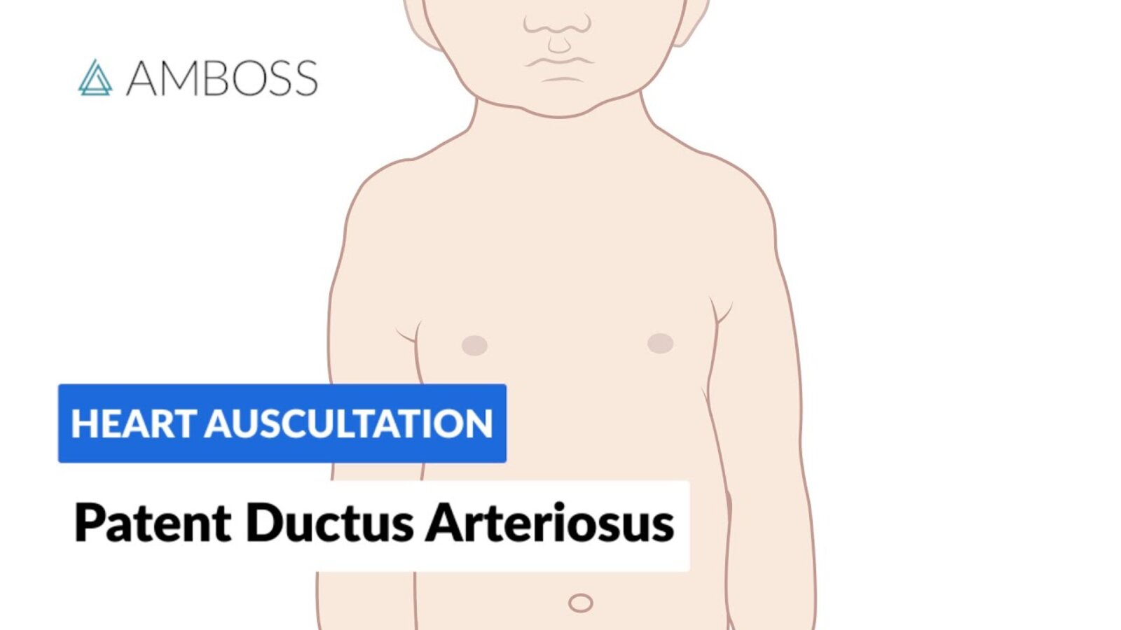 Patent Ductus Arteriosus - Heart Auscultation - Episode 6
