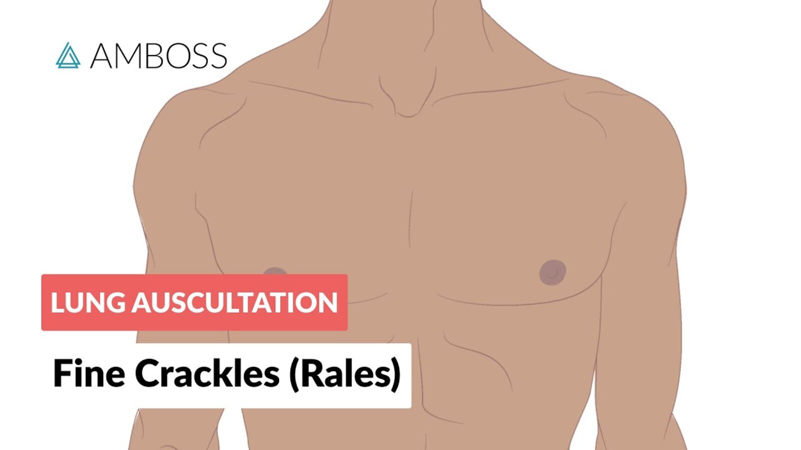 Fine Crackles (Rales) - Lung Auscultation - Episode 2 LC
