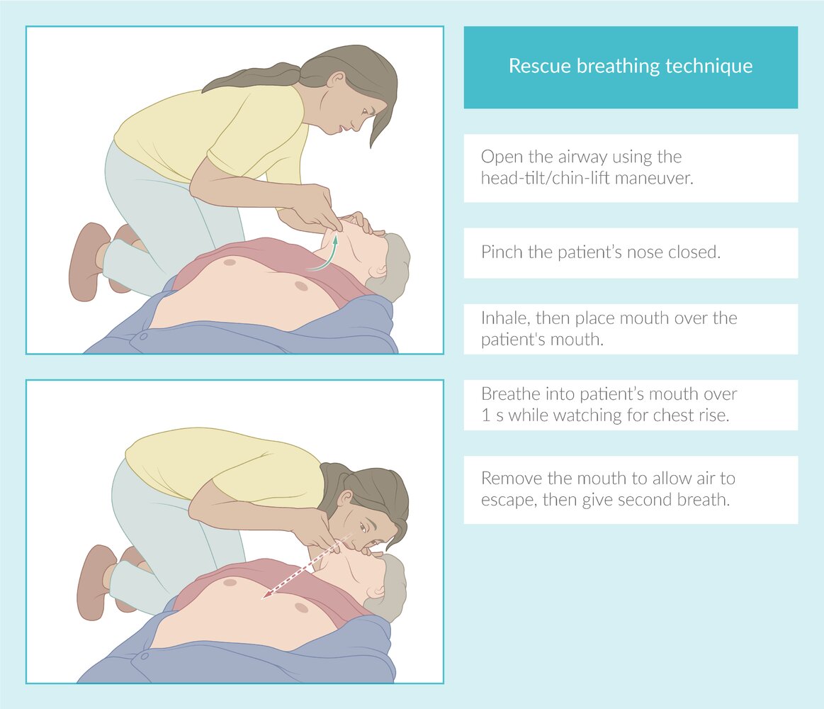 Rescue breathing technique