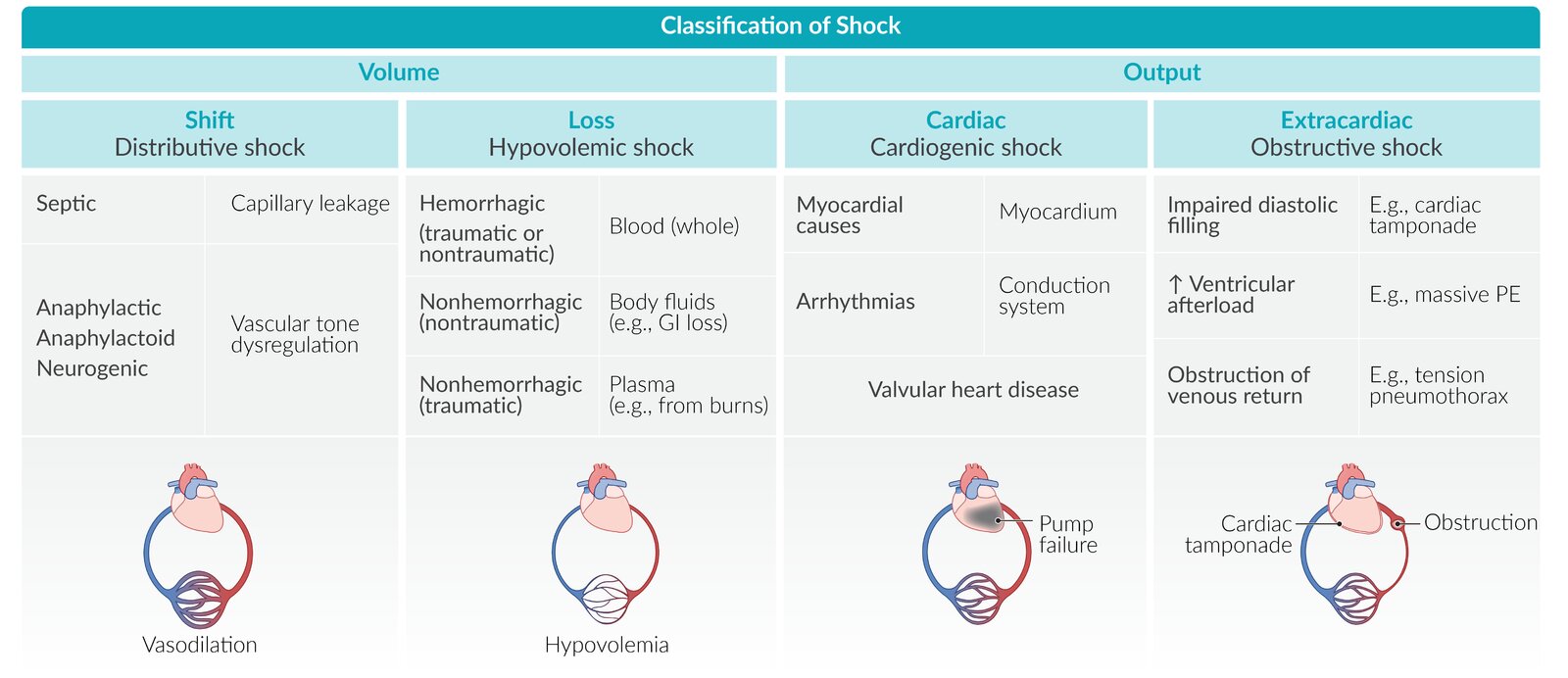 Classification of shock