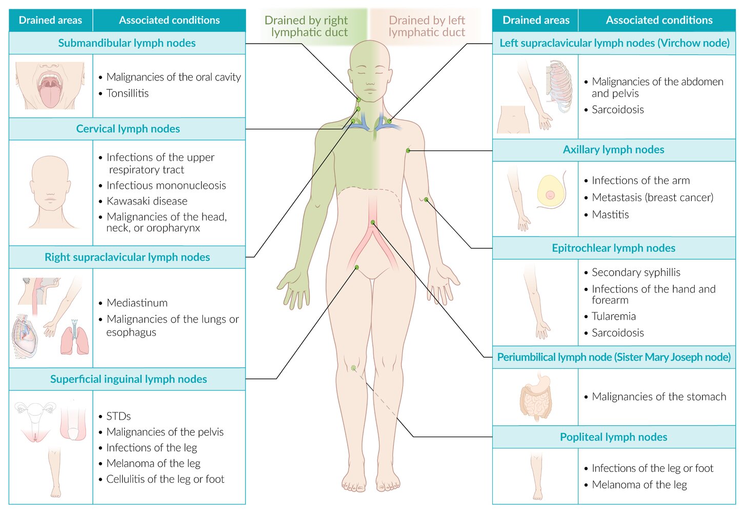 Palpable lymph nodes