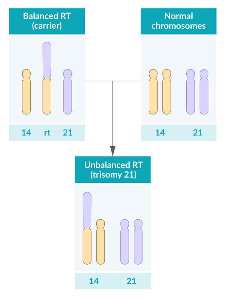 Robertsonian Translocation 2