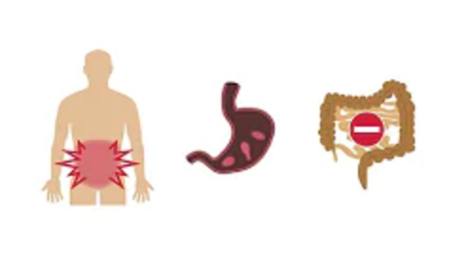 Recognizing an acute abdomen