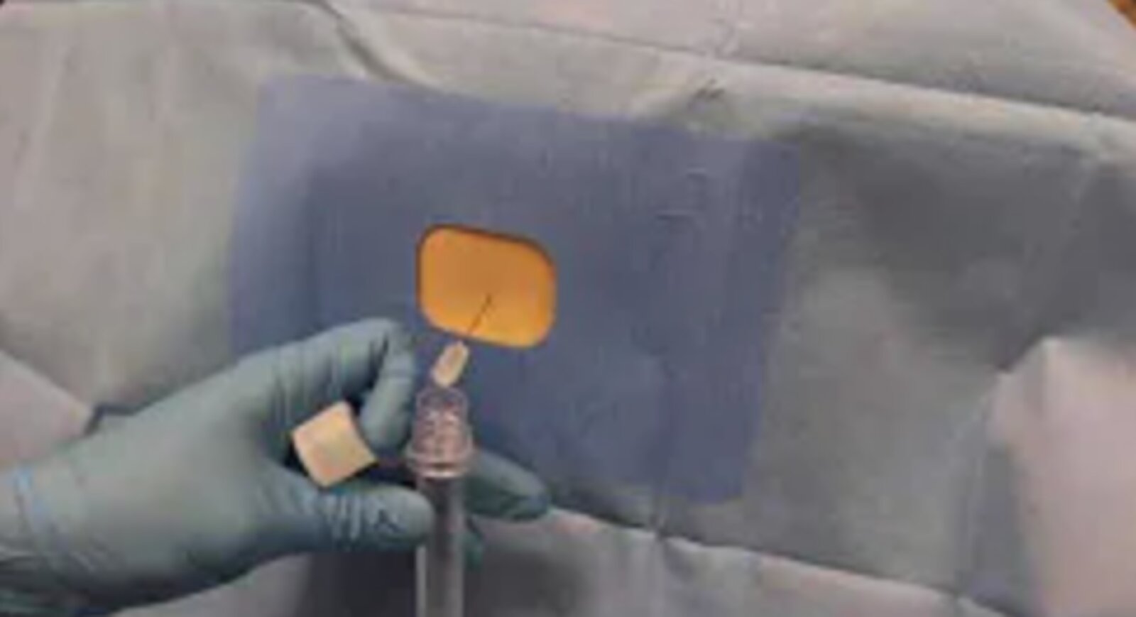 Lumbar puncture procedure