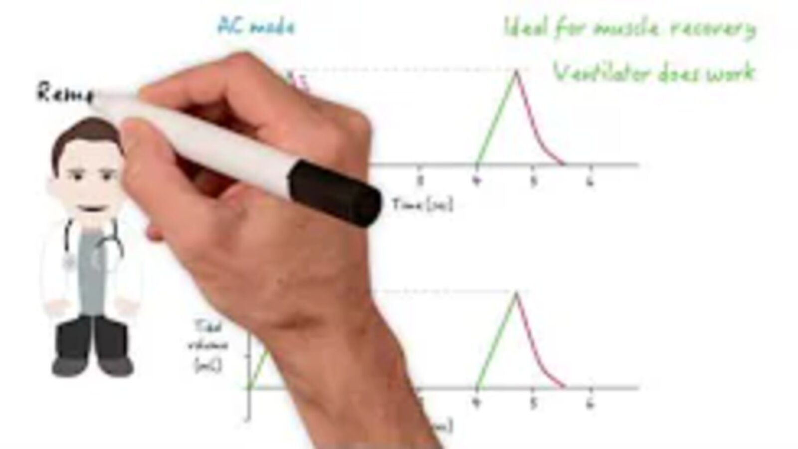 Assist control (AC) and synchronized intermittent mandatory ventilation (SIMV) modes