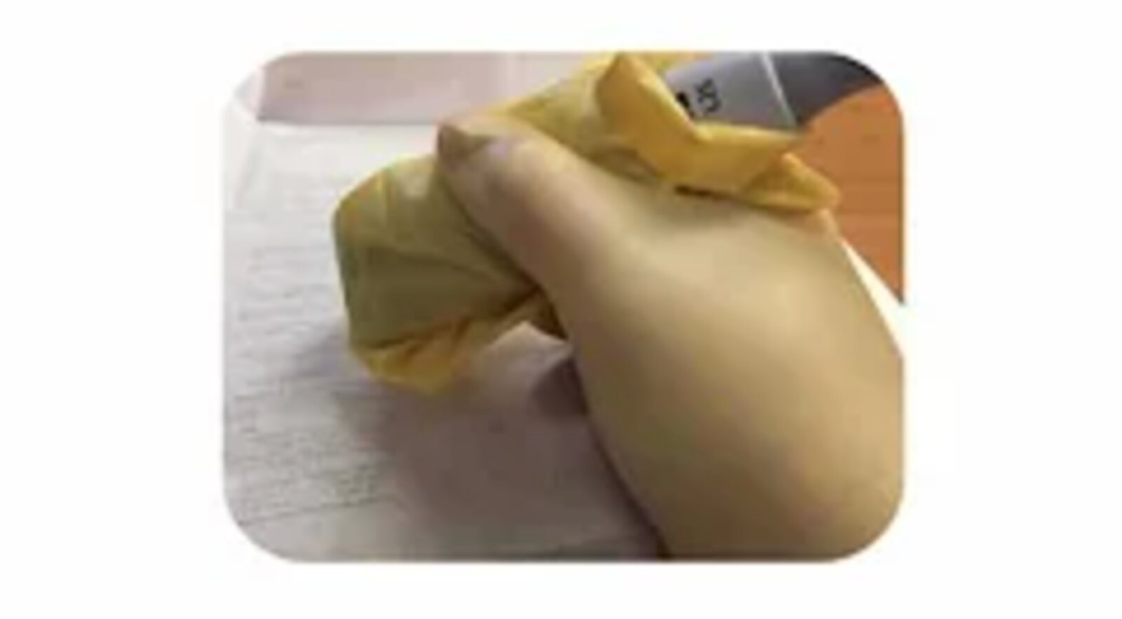 Ultrasound-guided incision and drainage of an abscess