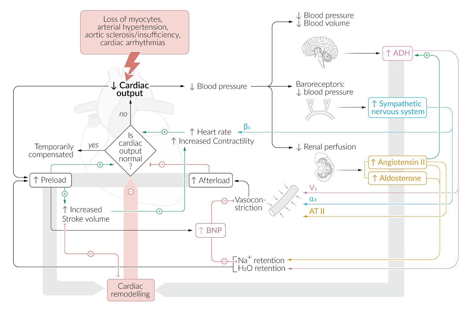 Pathophysiology of heart failure