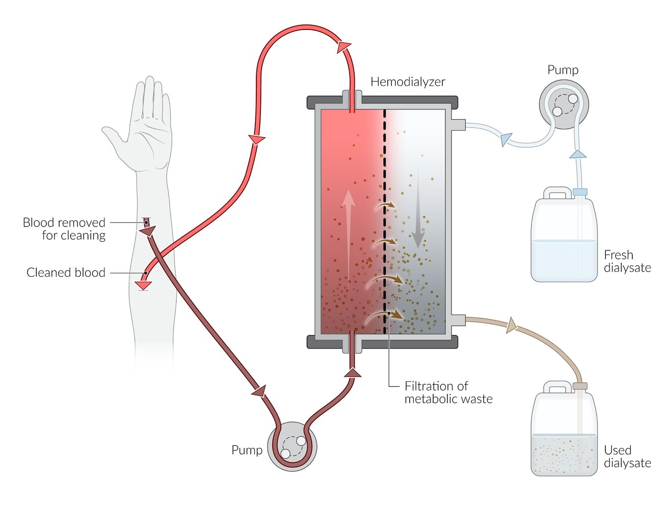 Dialysis circuit