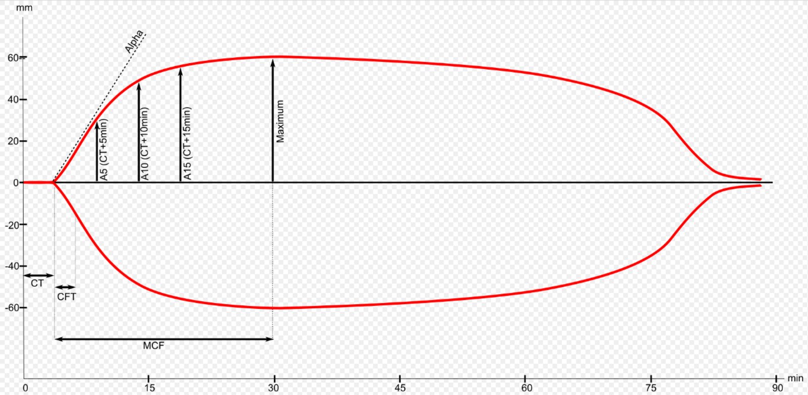 Thromboelastogram (TEG)
