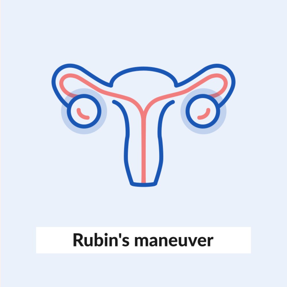 Rubin II maneuver