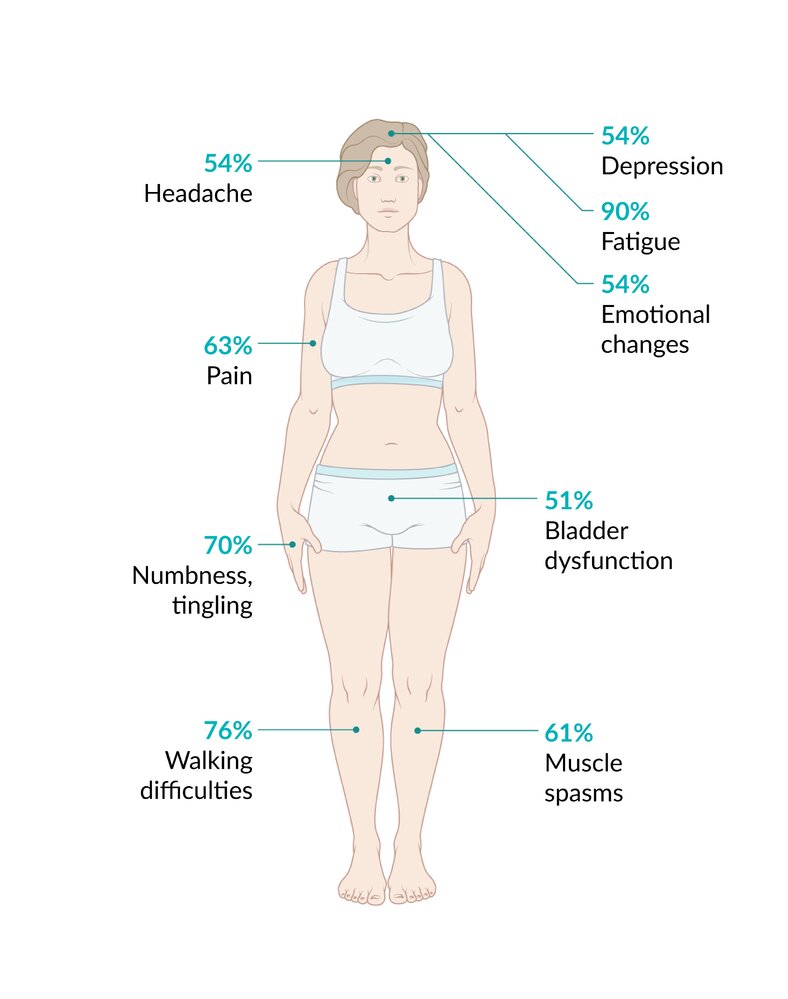 Multiple sclerosis symptoms