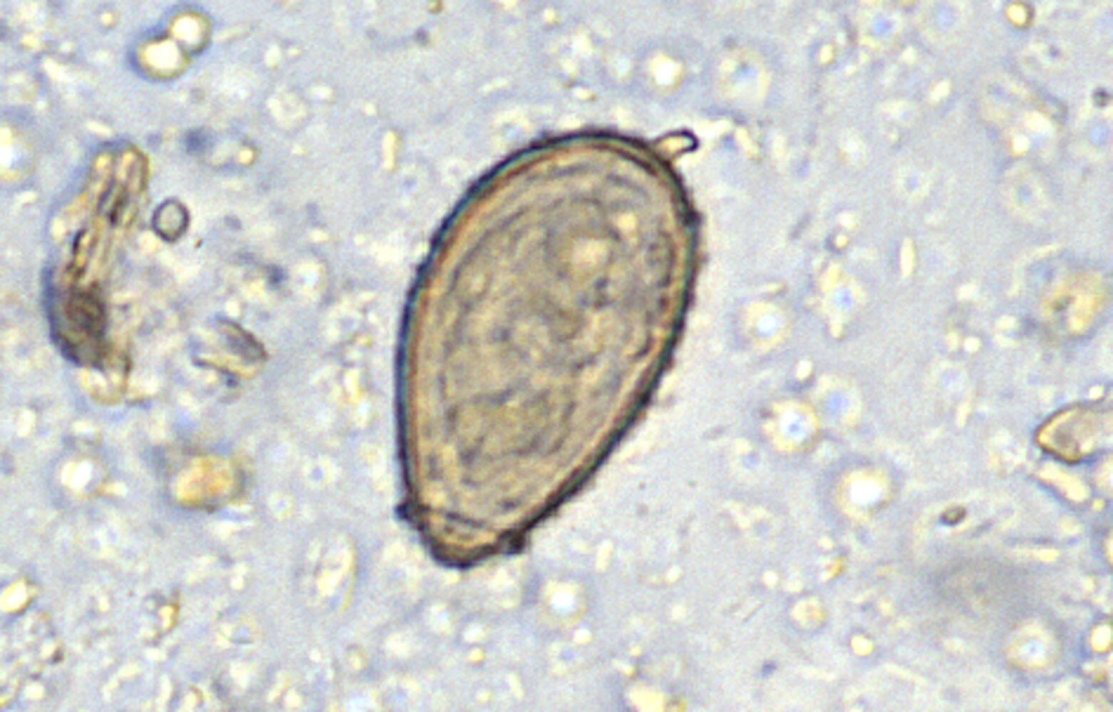 Clonorchis sinensis egg