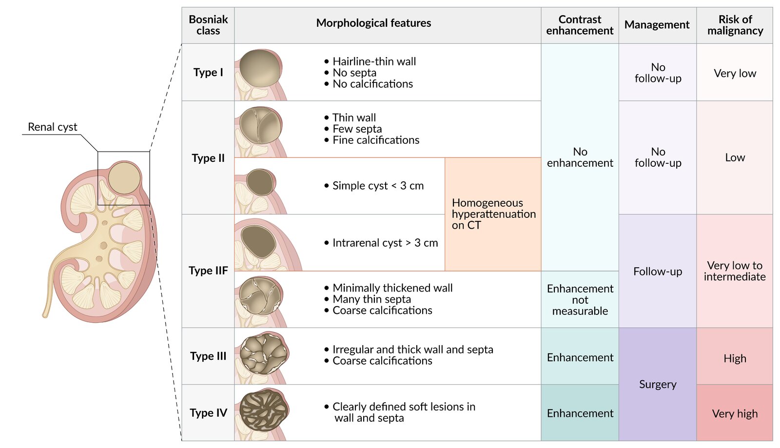 Bosniak classification of cystic renal masses