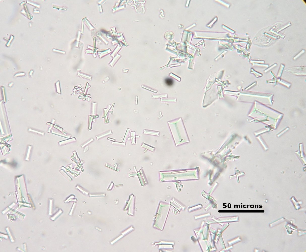 Struvite crystals