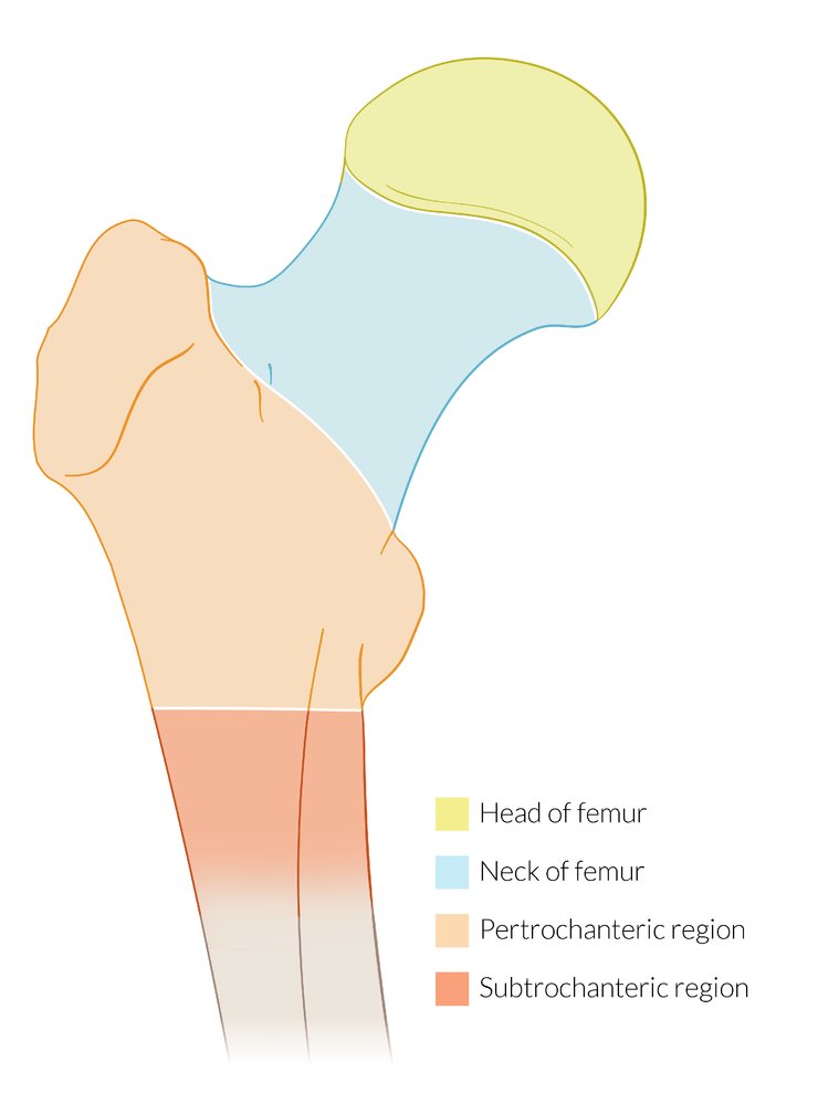 Regions of the proximal femur