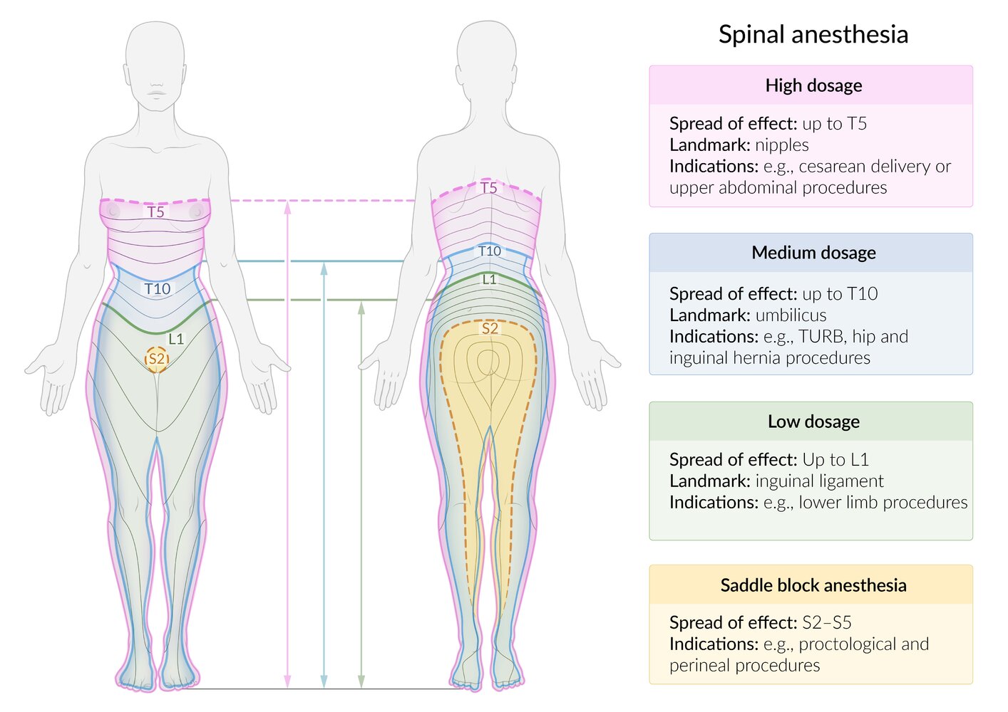Spread of effect of spinal anesthesia