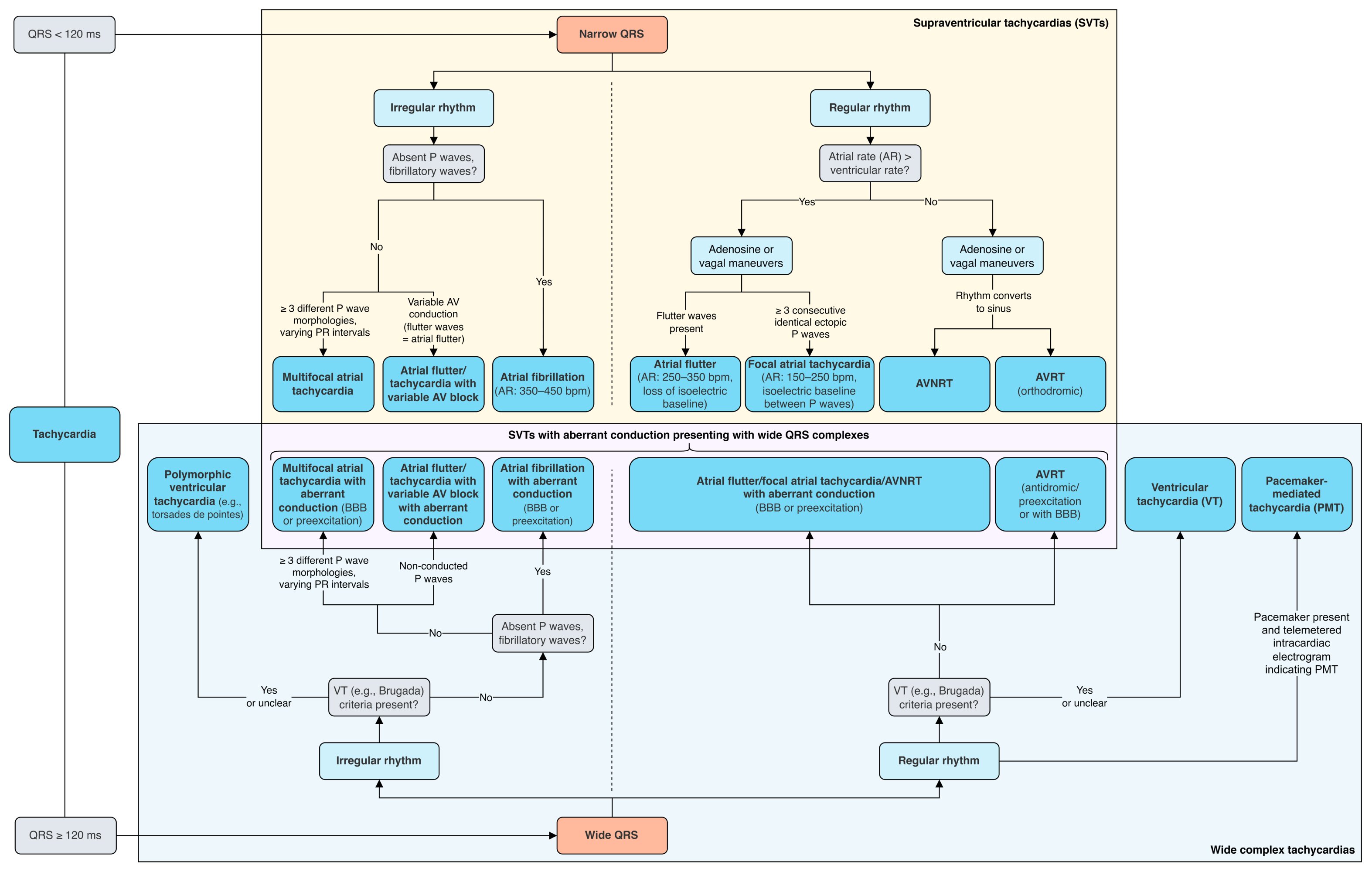 Tachycardia differentials