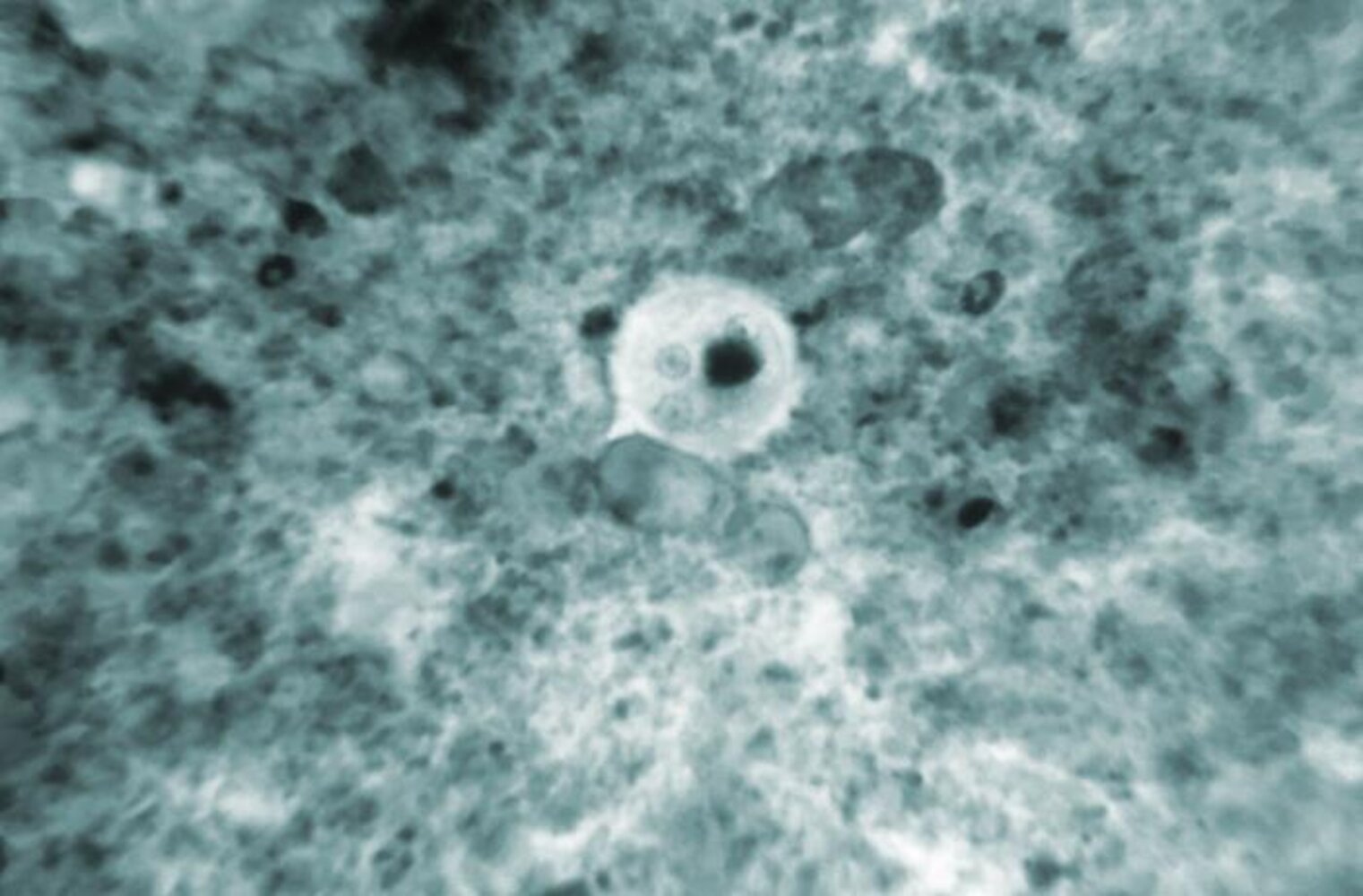 Entamoeba histolytica cyst