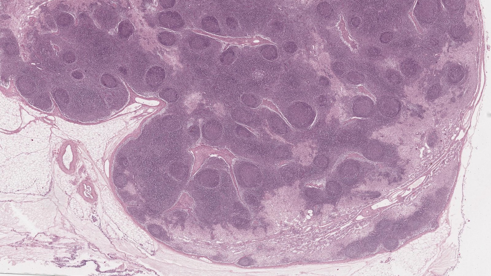 Fine structure of a lymph node