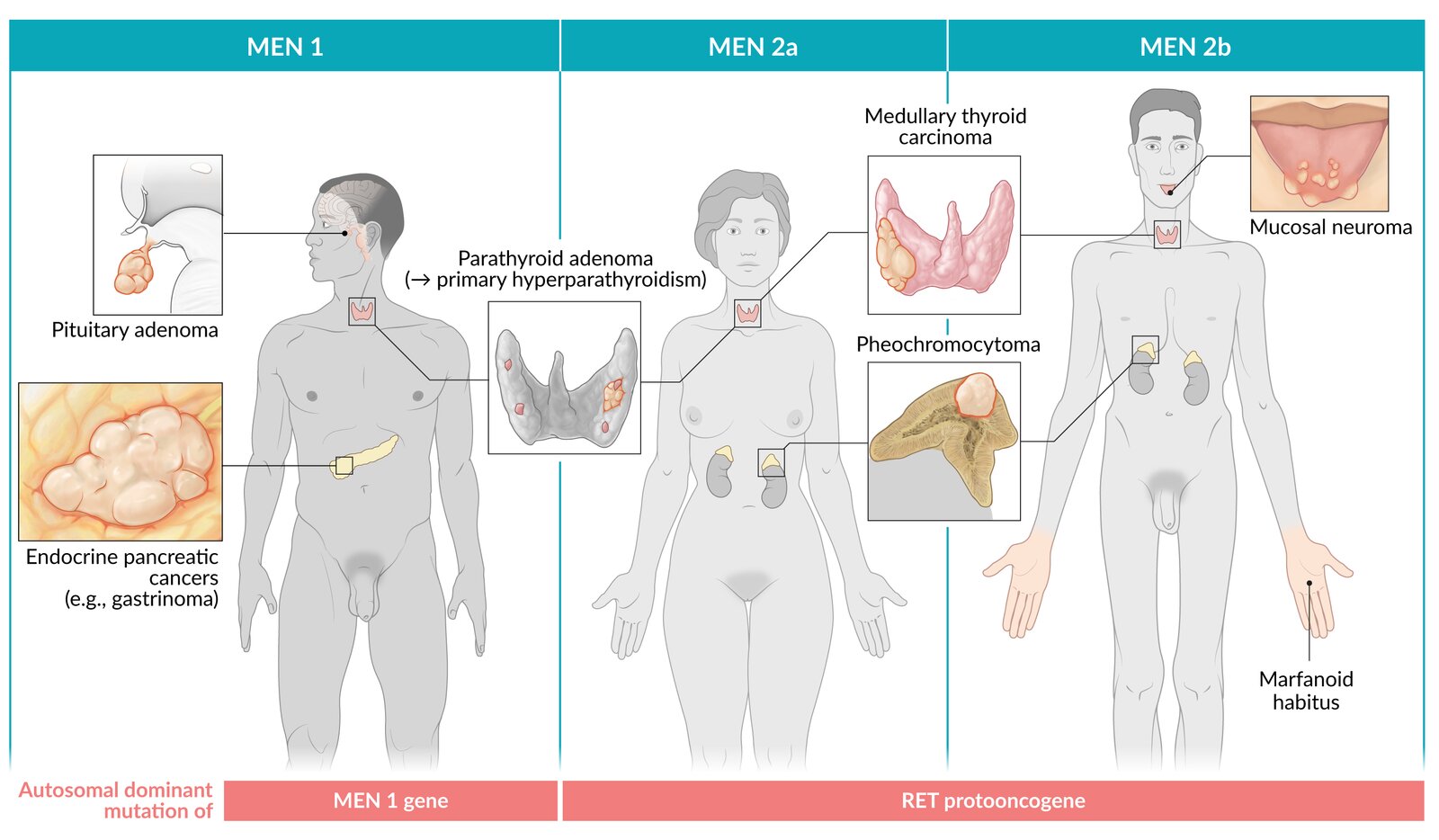 MEN (multiple endocrine neoplasia) syndromes