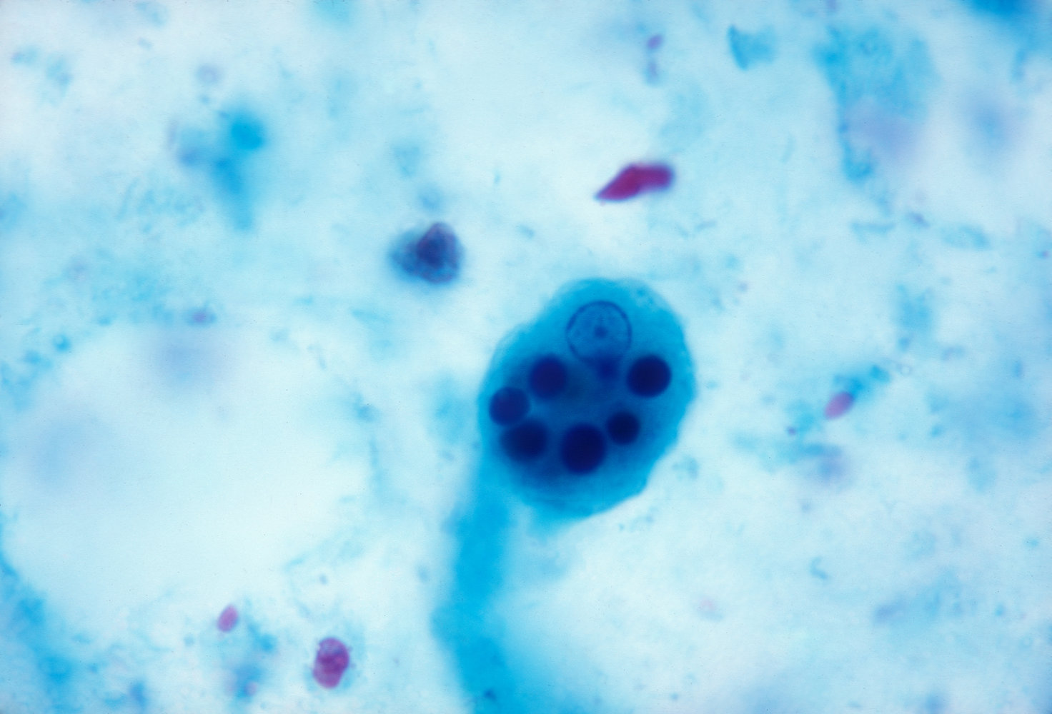 Entamoeba histolytica trophozoite