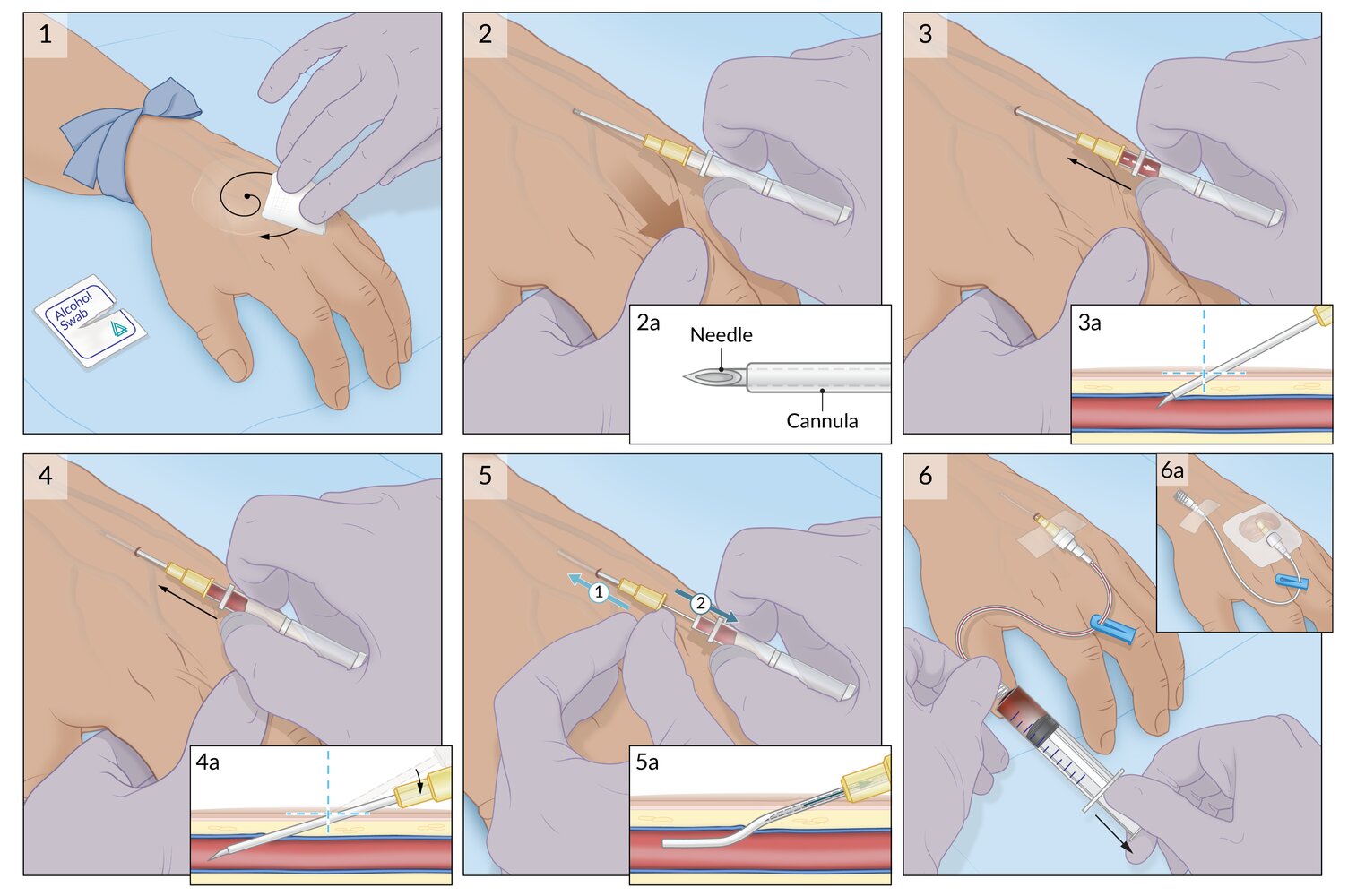 Peripheral venous access