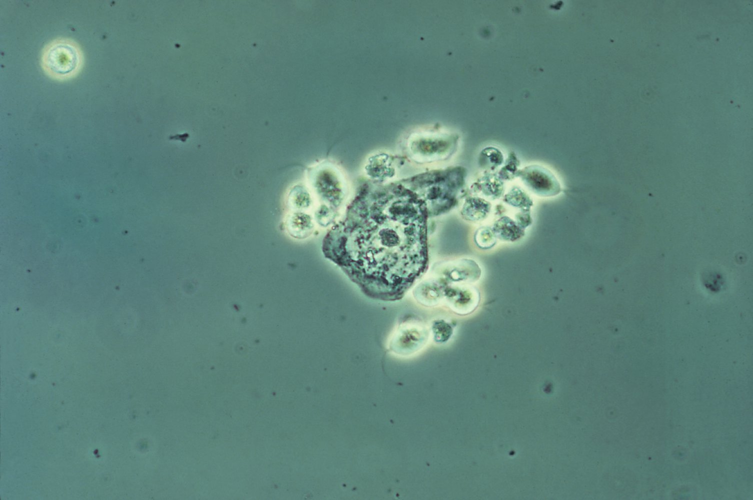 Trichomonas vaginalis