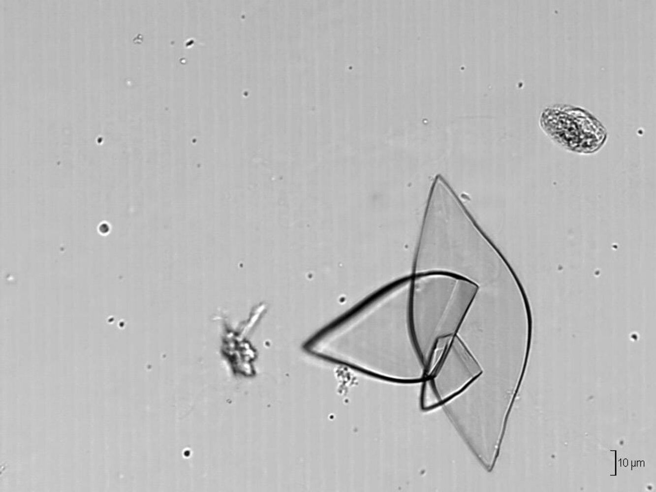 Uric acid crystals
