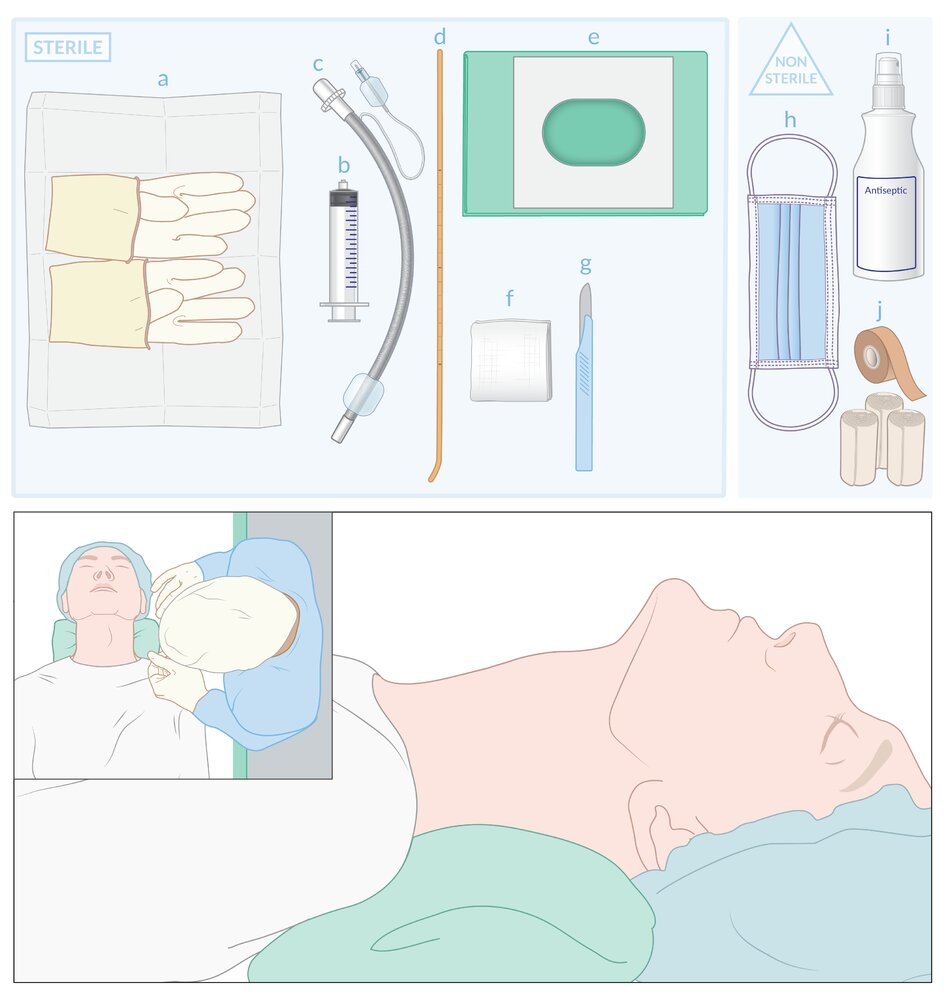 Surgical cricothyrotomy: stab-twist-bougie-tube technique equipment