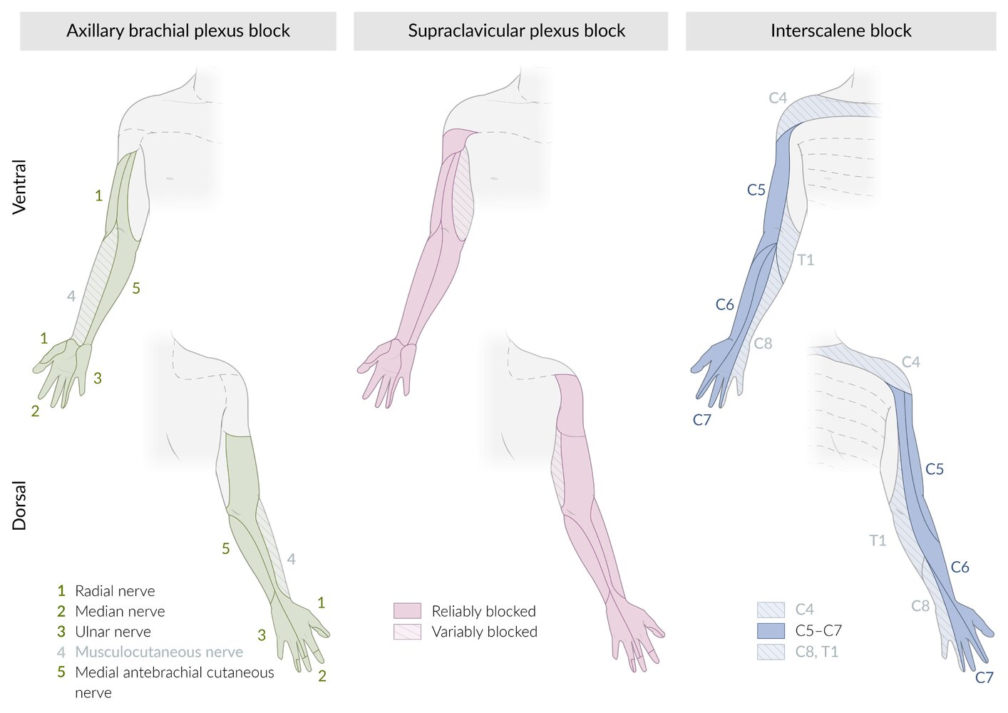 Upper extremity peripheral nerve blocks