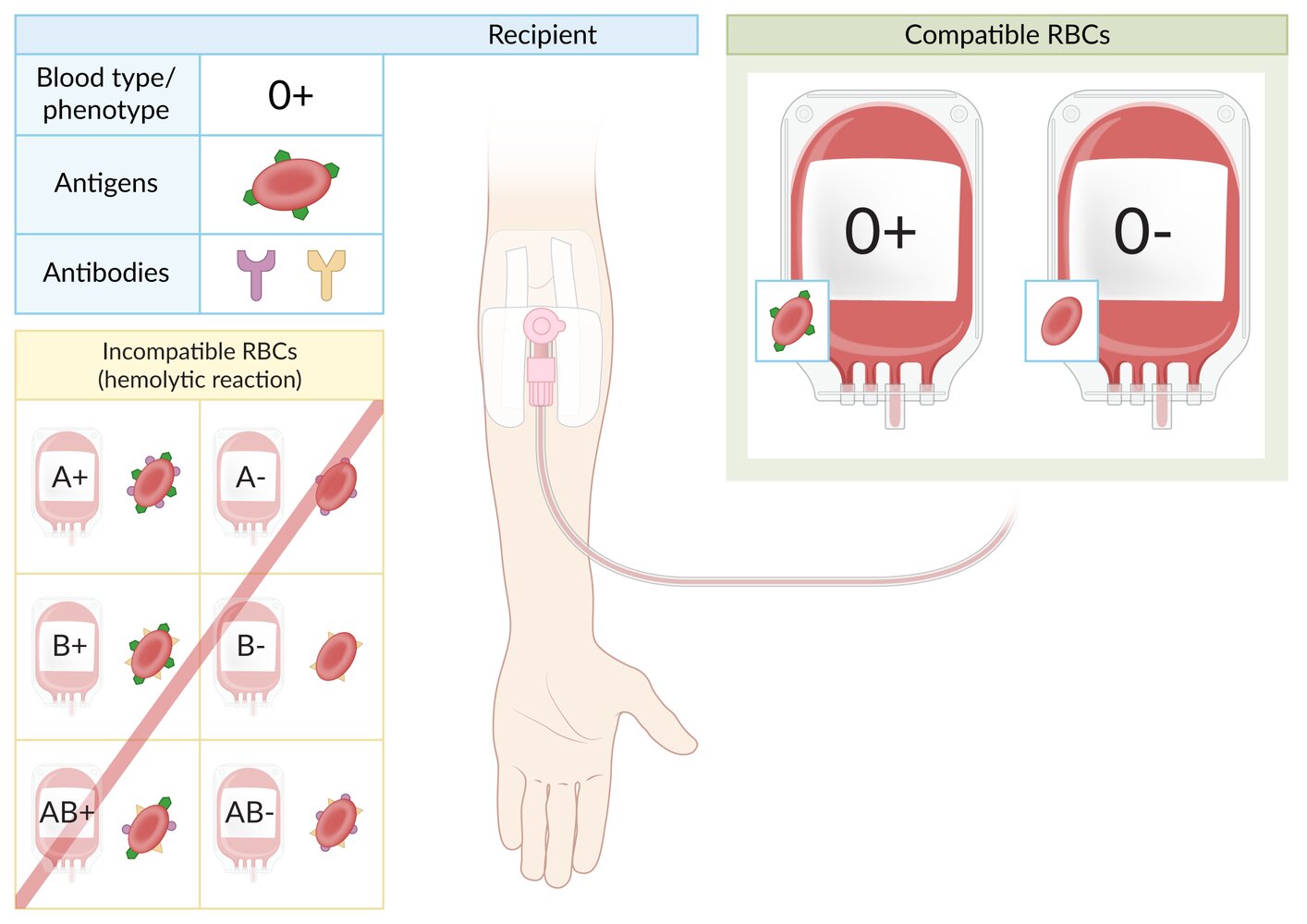 Blood type O+ RBC transfusion compatibility