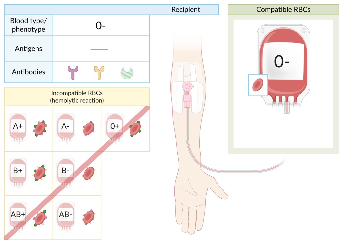 Blood type O- RBC transfusion compatibility