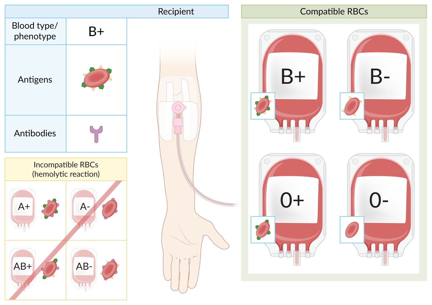 Blood type B+ RBC transfusion compatibility