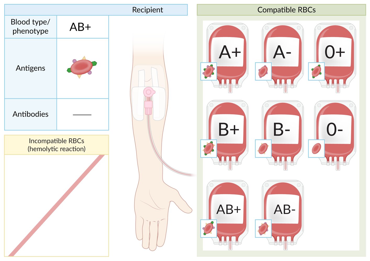 Blood type AB+ RBC transfusion compatibility