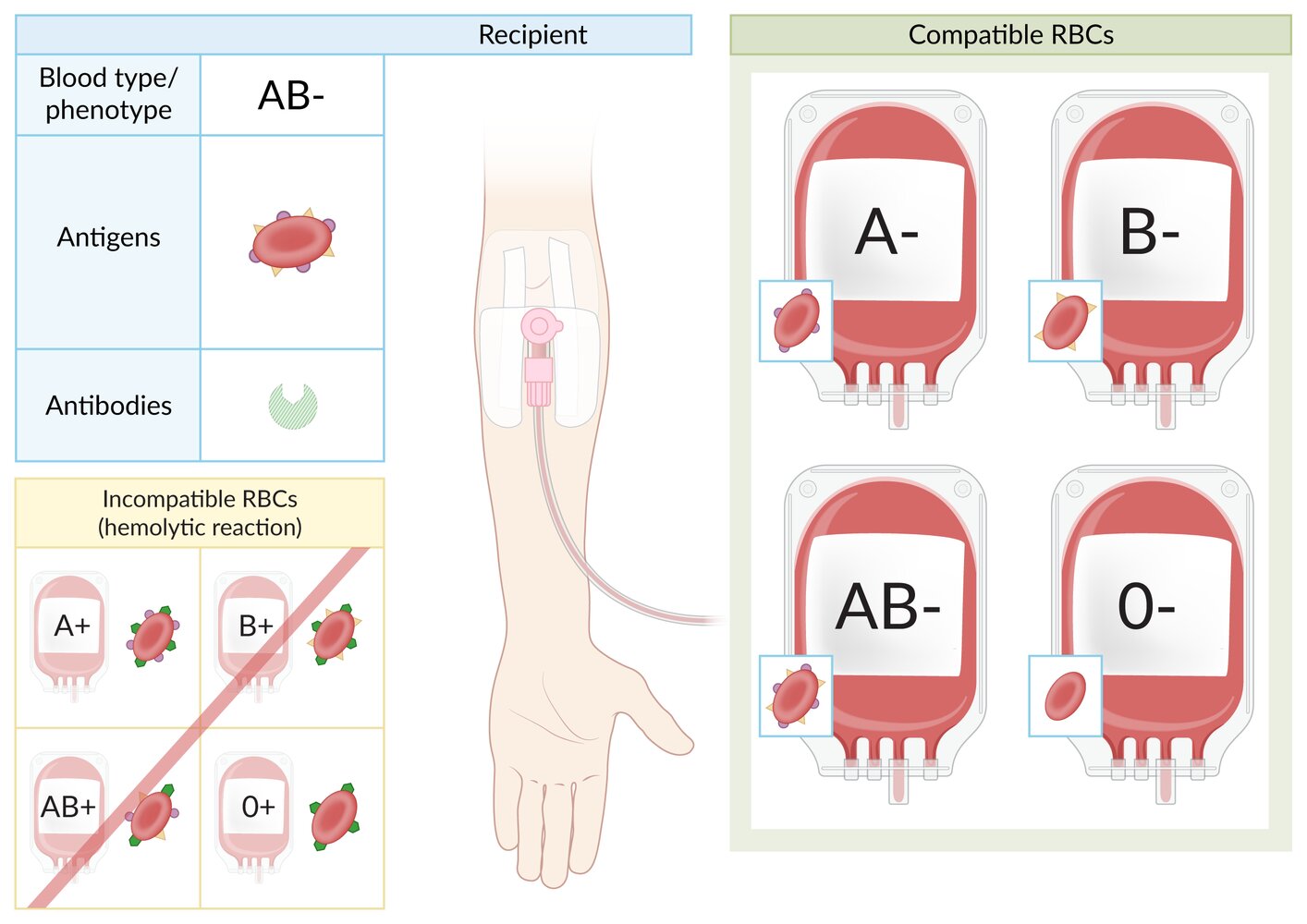 Blood type AB- RBC transfusion compatibility