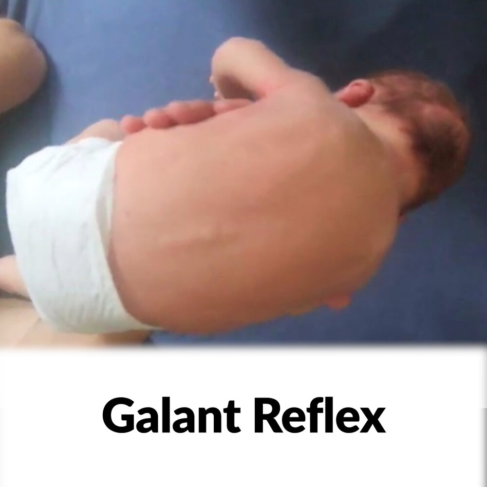 Galant Reflex - Clinical Examination