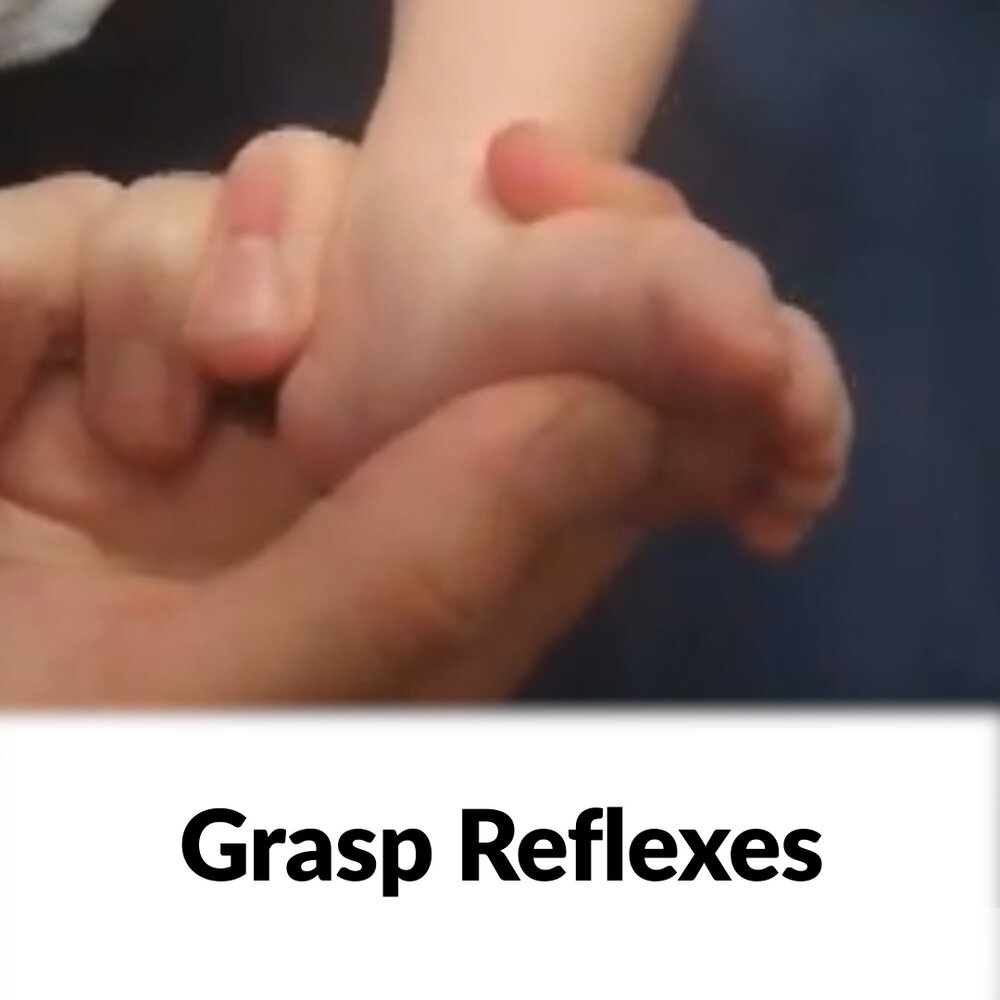 Grasp Reflexes - Clinical Examination
