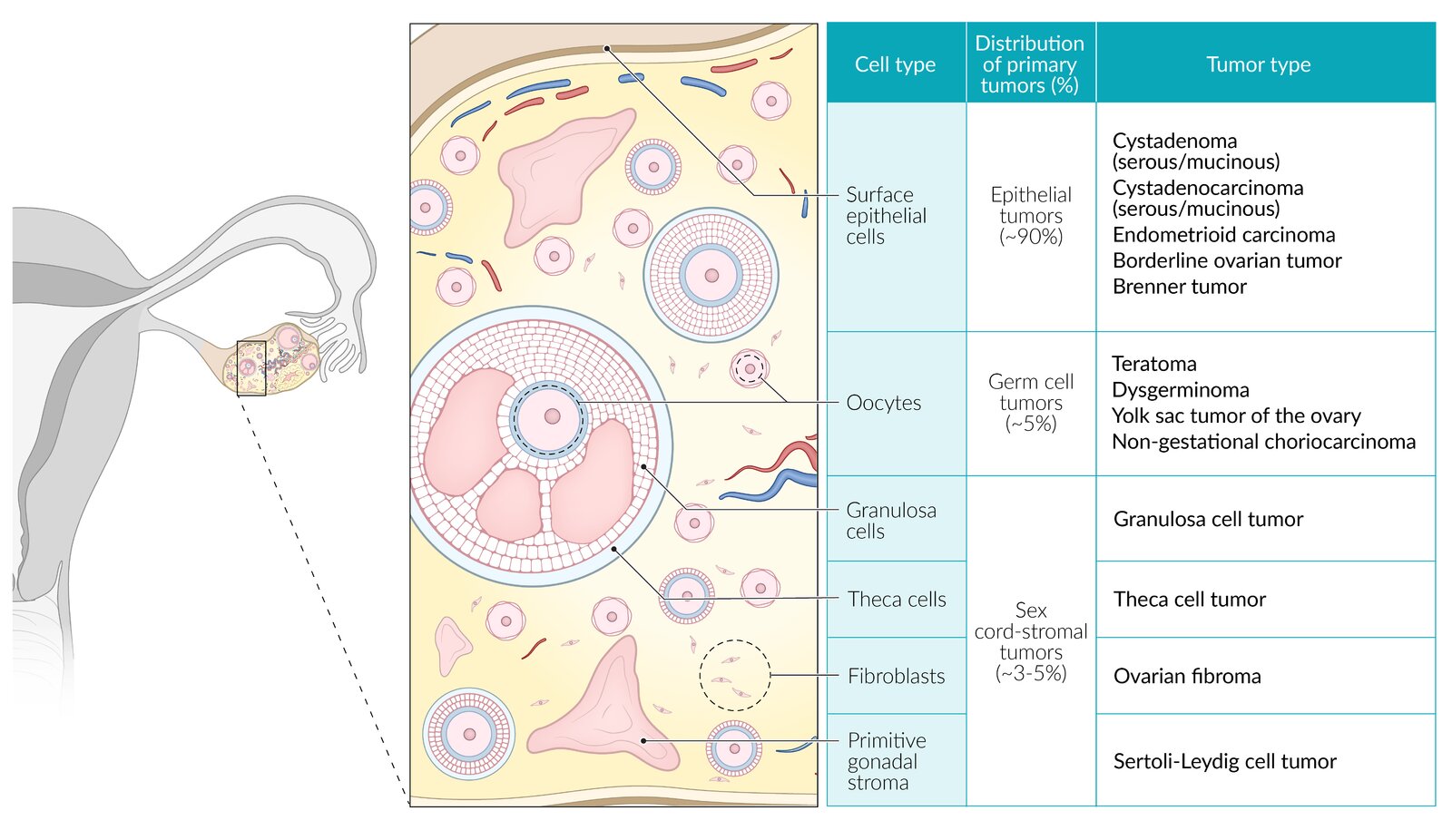 Cellular origins of ovarian tumors
