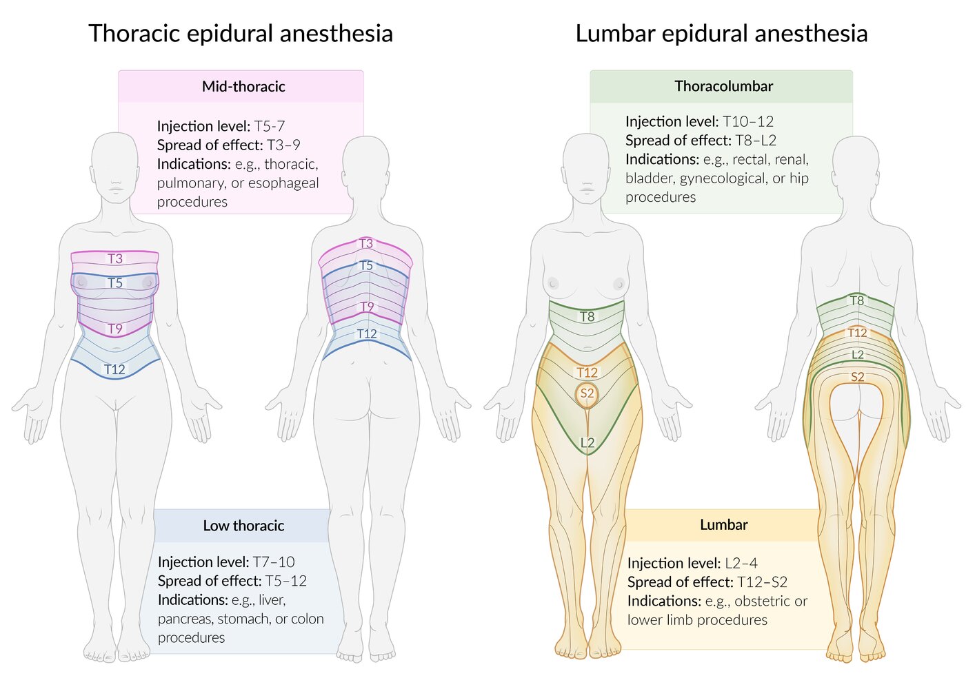 Spread of effect of epidural anesthesia