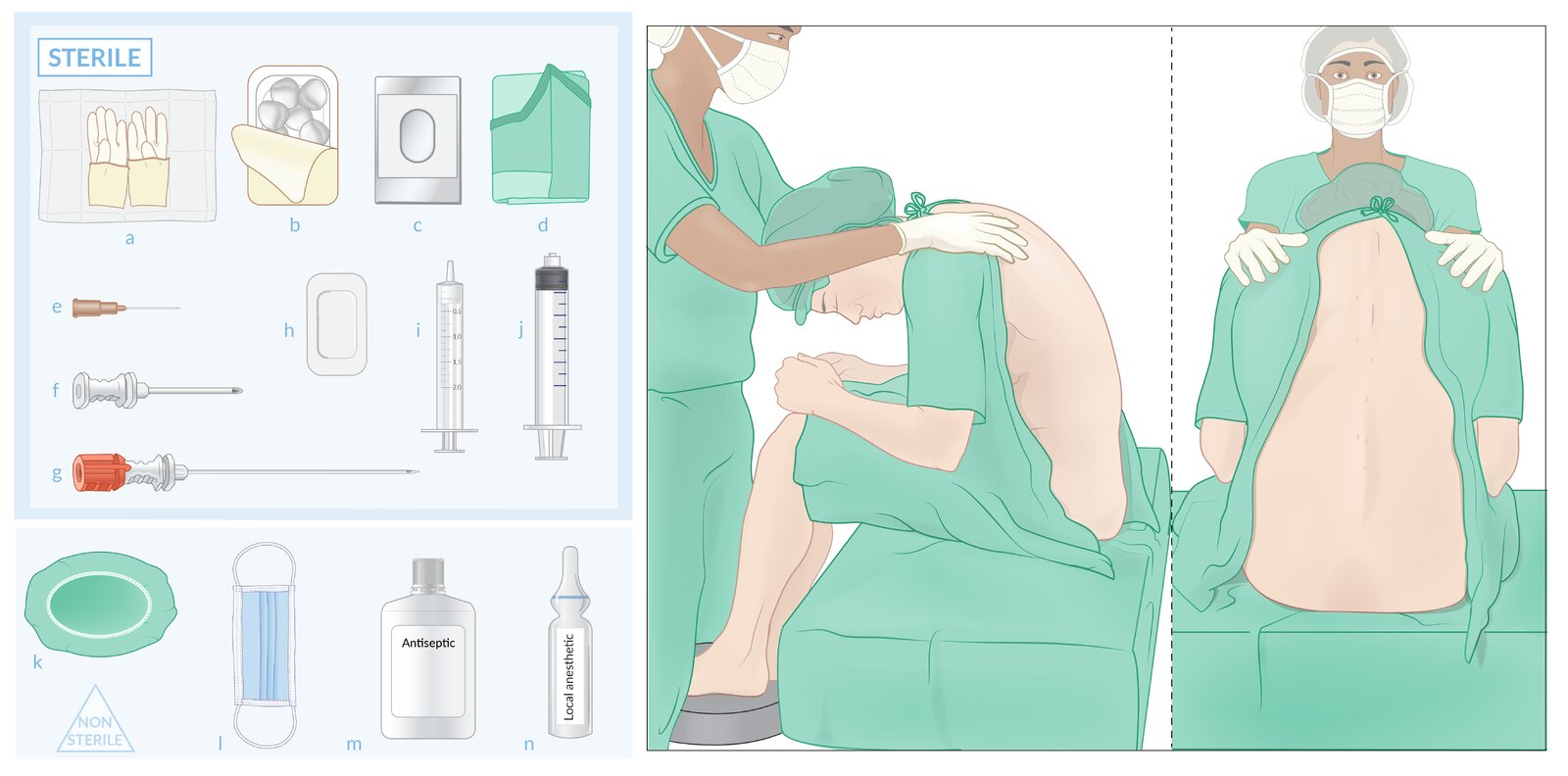 Spinal anesthesia (1/2): materials and patient positioning
