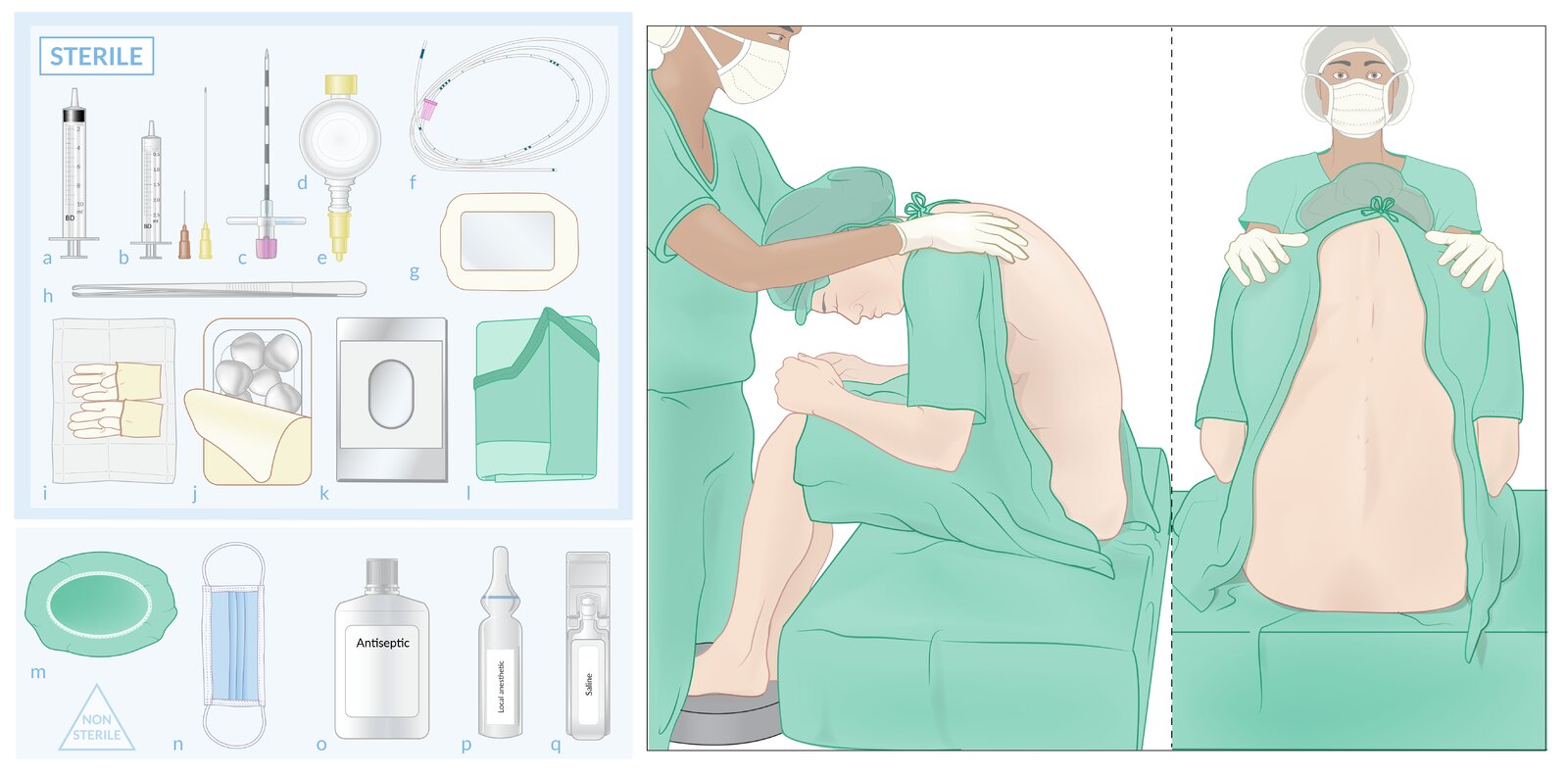 Epidural anesthesia (1/2): materials and patient positioning