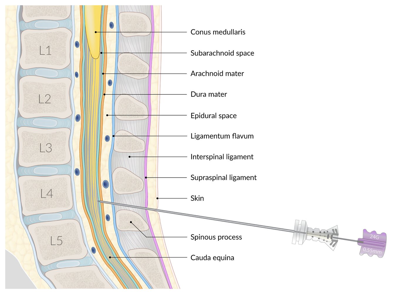Anatomical structures in lumbar puncture, spinal anesthesia, and epidural anesthesia