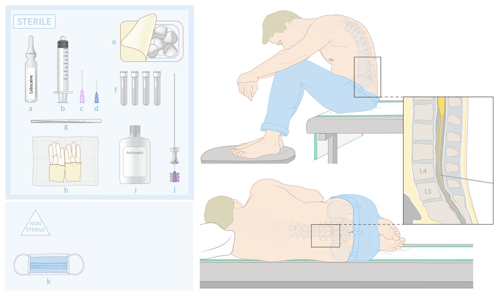 Lumbar puncture (1/2): materials, patient positioning, and puncture site