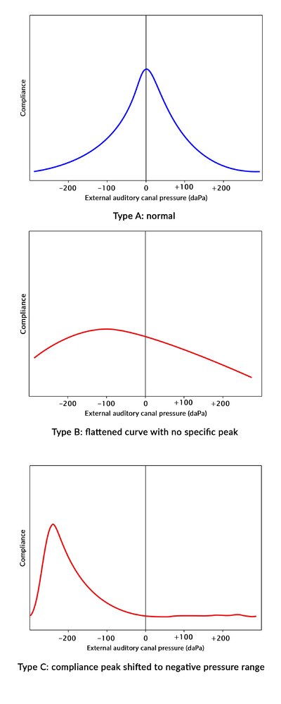 Tympanogram