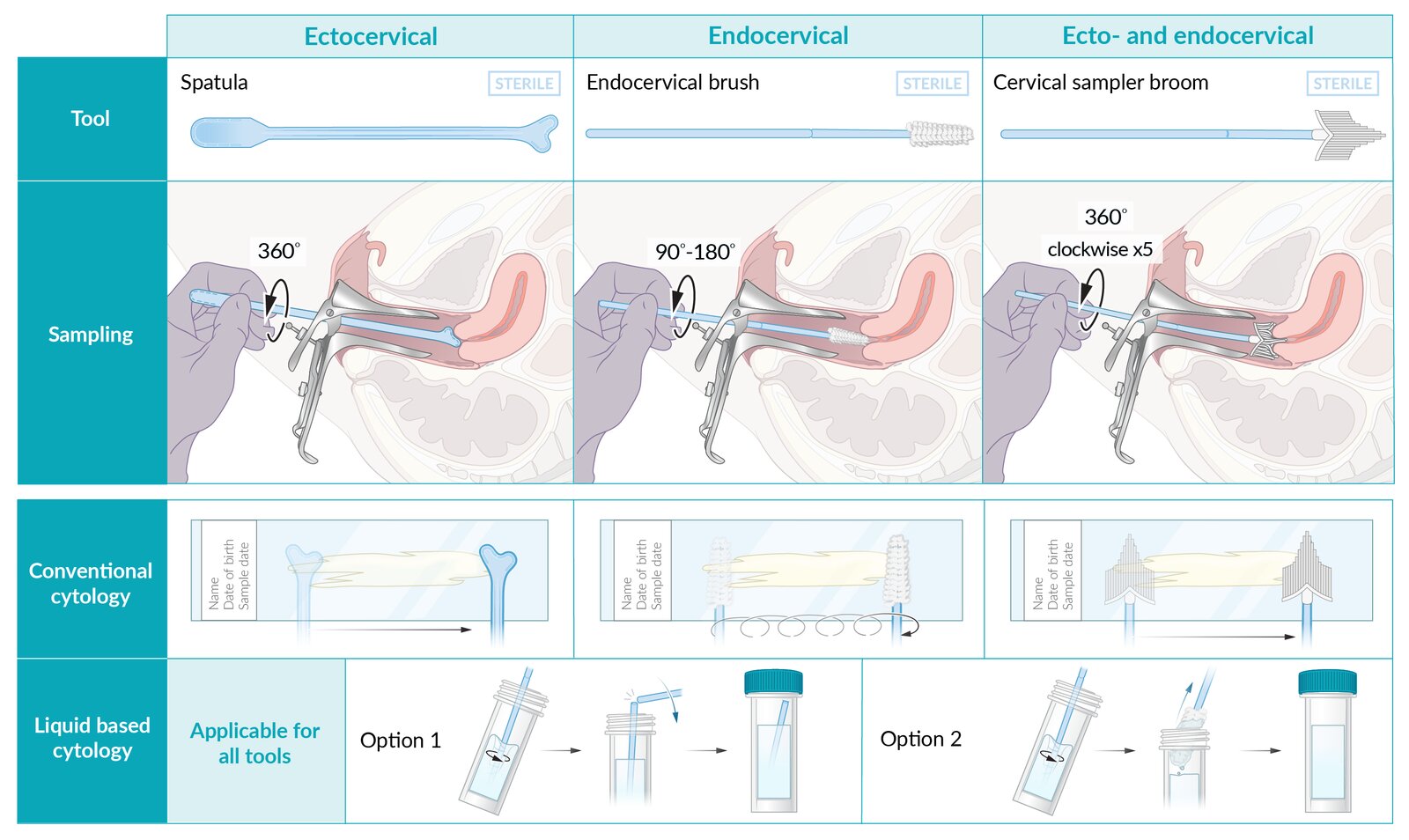 Pap smear: tools, sample collection, and sample preparation