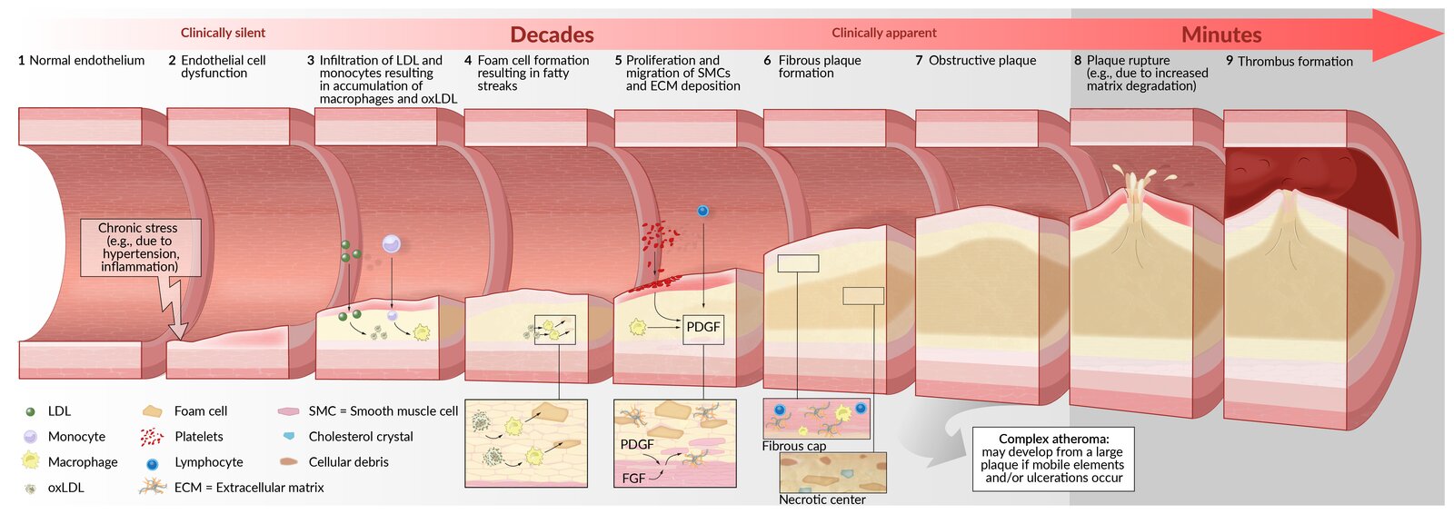 Pathogenesis of atherosclerosis