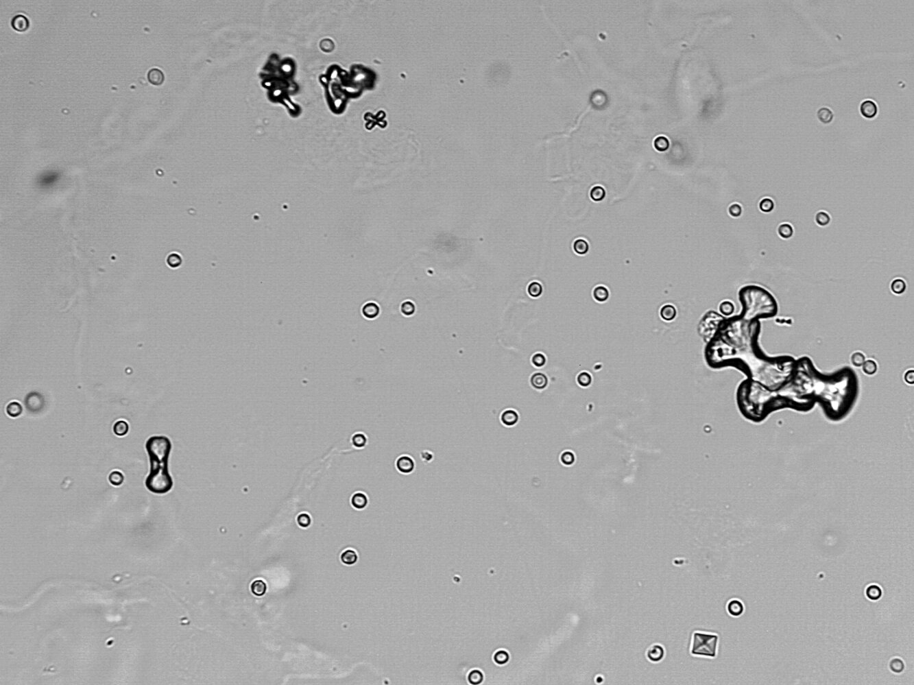 Calcium oxalate crystals